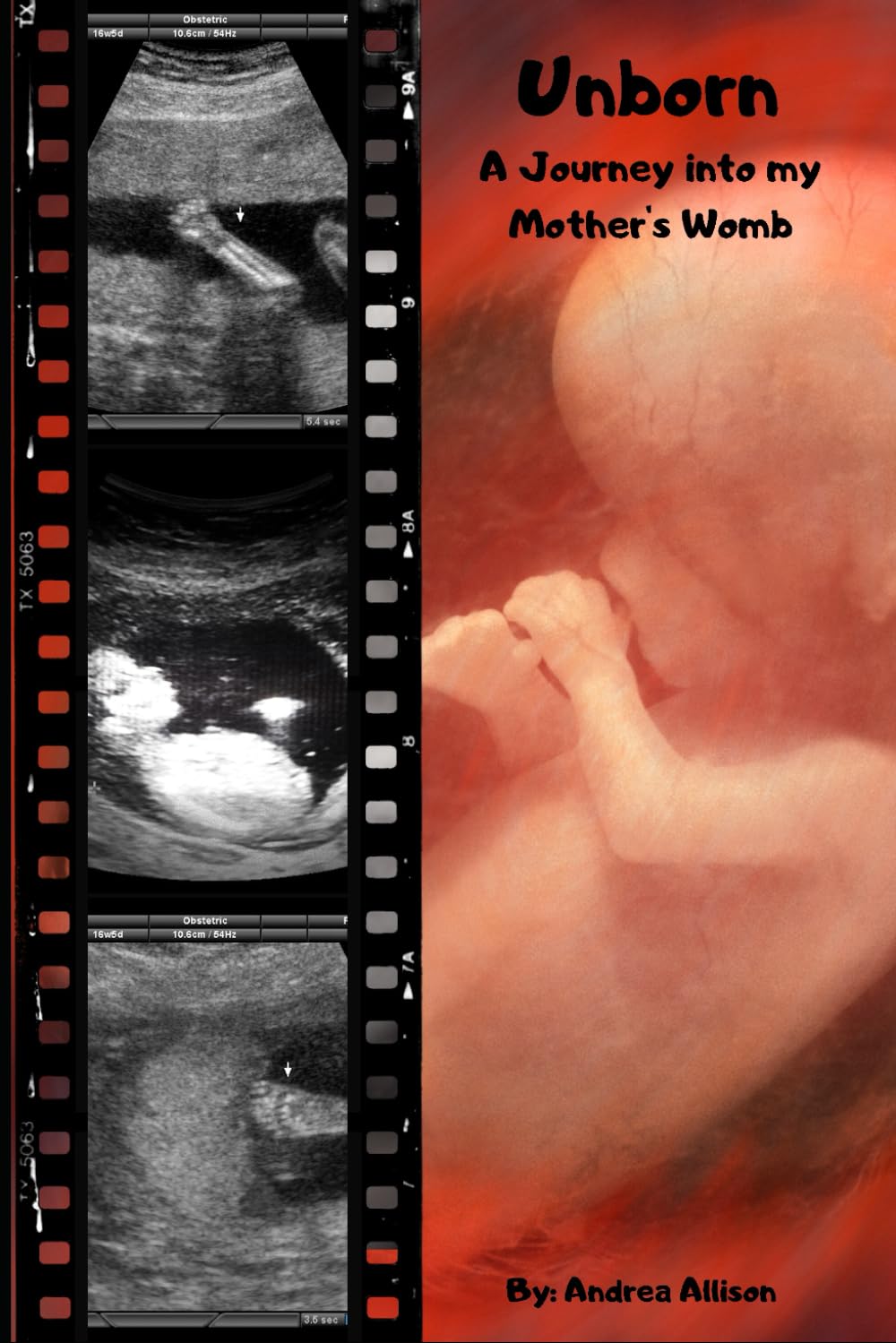 Unborn: A Journey into my Mother's Womb